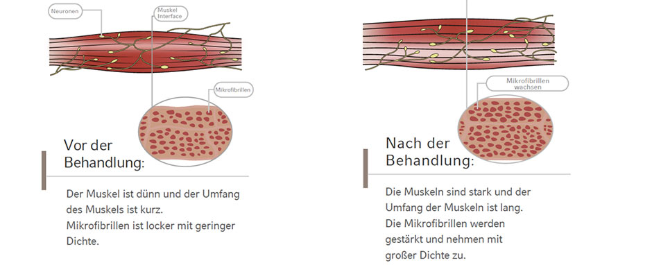 Tesla Shape - bahnbrechende Technologie